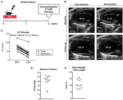 Myocardial Infarction After High-Dose Catecholamine Application—A Case Report From an Experimental Imaging Study